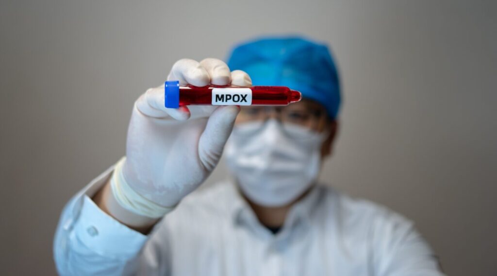 Mpox 1280x710